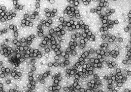 Japanese encephalitis virus